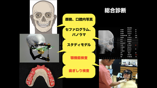 顎関節症、噛み合わせの治療 - ナカヤマデンタルオフィス（中央区築地駅）