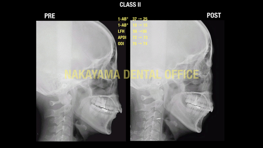 Radiographic Cephalometry   歯科　本　矯正